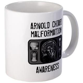 Arnold Chiari Malformation Mugs  Buy Arnold Chiari Malformation