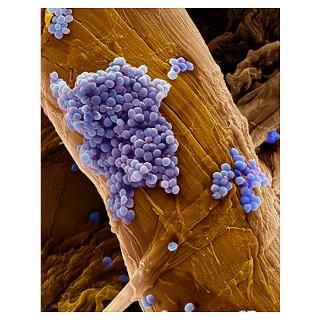 Wall Art  Posters  Streptococcus pneumoniae