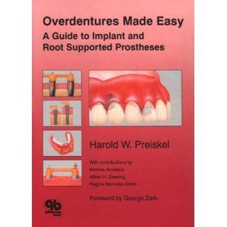 Overdentures Made Easy A Guide to Implant and Root Supported